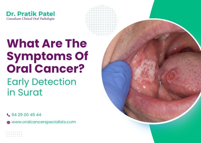 What Are the Symptoms of Oral Cancer? Early Detection in Surat