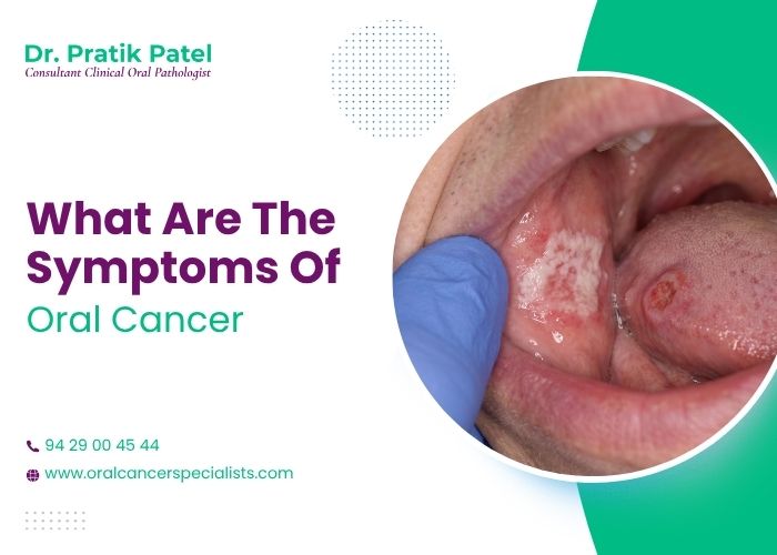 What are the Symptoms of Oral Cancer